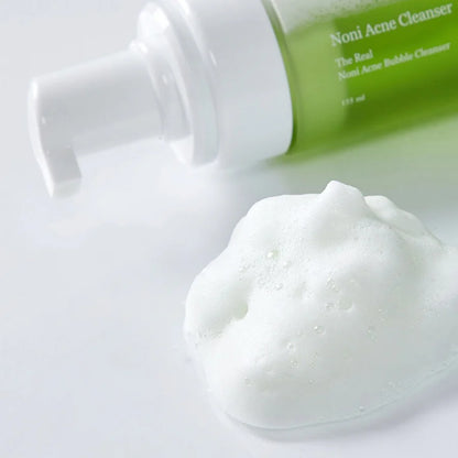 The Real Noni Acne Bubble Cleanser (Limpiador en Espuma para Acné)