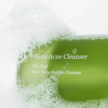 The Real Noni Acne Bubble Cleanser (Limpiador en Espuma para Acné)