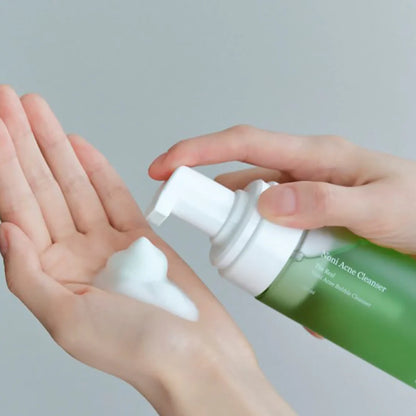 The Real Noni Acne Bubble Cleanser (Limpiador en Espuma para Acné)