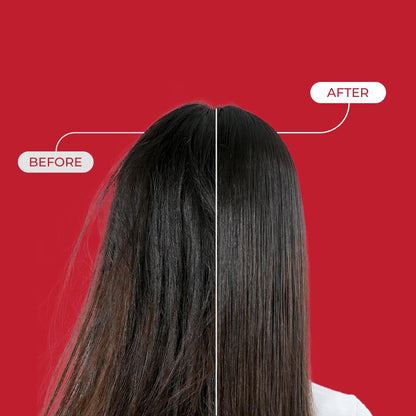 Annurcatin Hair Tonic (Tónico Capilar Anticaída)